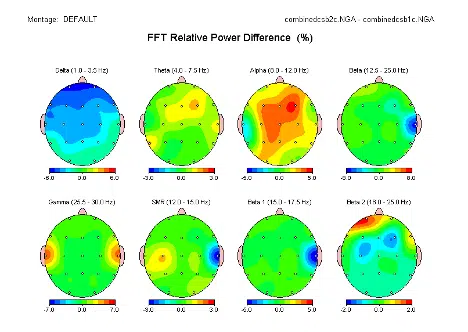 FFT Relative Power Difference